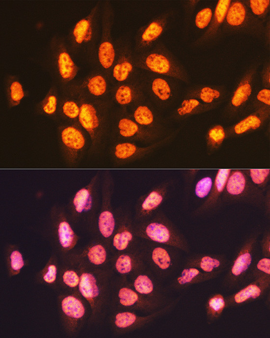 ENT2 Antibody in Immunocytochemistry (ICC/IF)