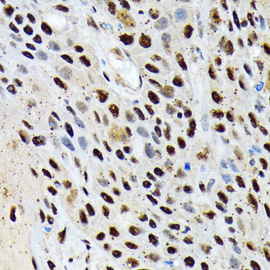 ENT2 Antibody in Immunohistochemistry (Paraffin) (IHC (P))