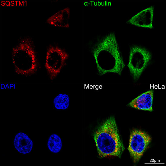 SQSTM1 Antibody in Immunocytochemistry (ICC/IF)