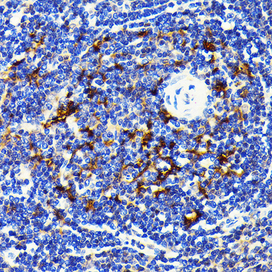 SQSTM1 Antibody in Immunohistochemistry (Paraffin) (IHC (P))