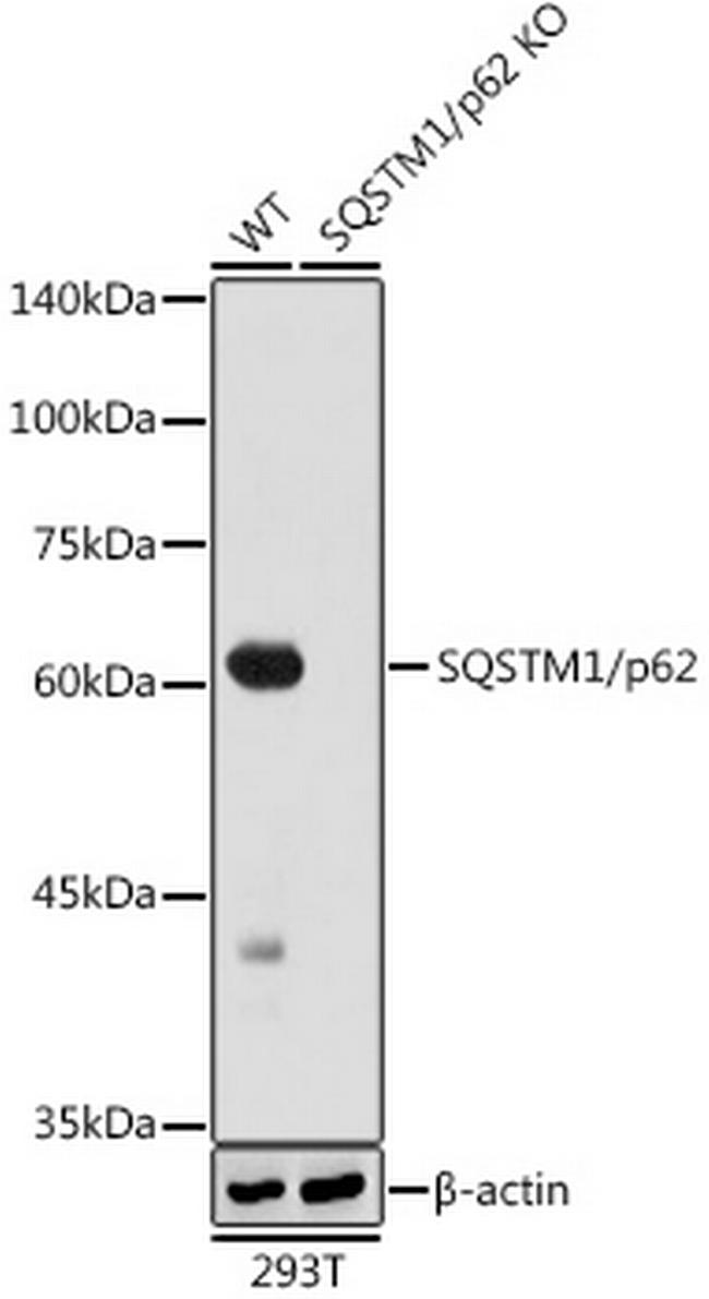 SQSTM1 Antibody