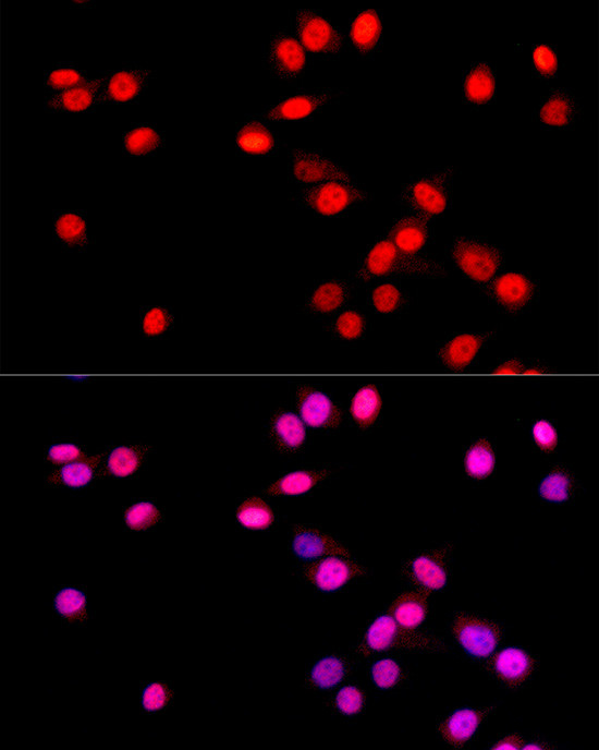 SOX9 Antibody in Immunocytochemistry (ICC/IF)