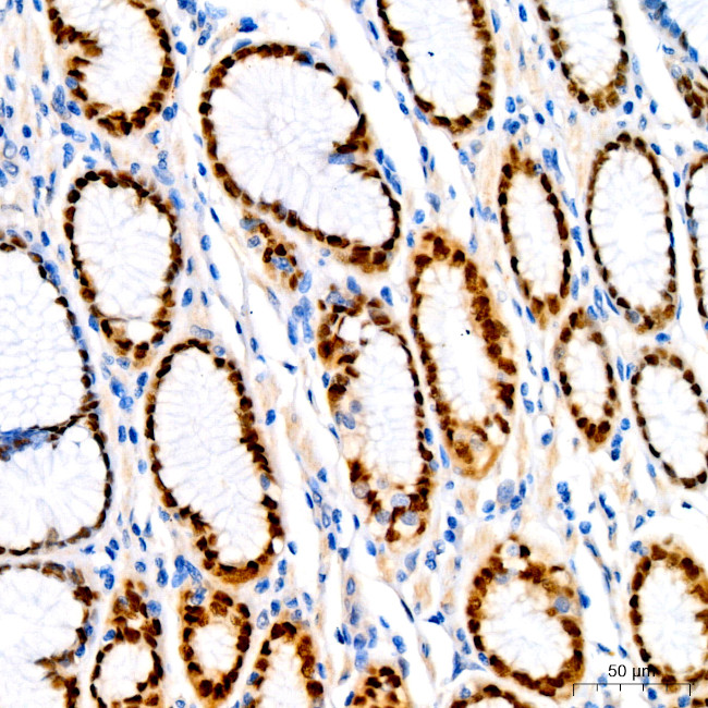 SOX9 Antibody in Immunohistochemistry (Paraffin) (IHC (P))