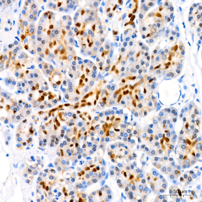 SOX9 Antibody in Immunohistochemistry (Paraffin) (IHC (P))