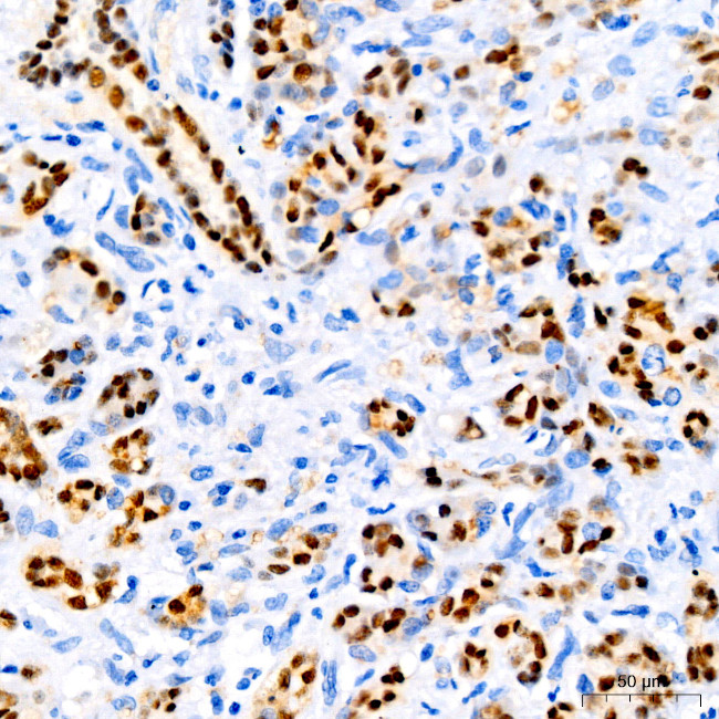 SOX9 Antibody in Immunohistochemistry (Paraffin) (IHC (P))