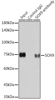 SOX9 Antibody in Immunoprecipitation (IP)