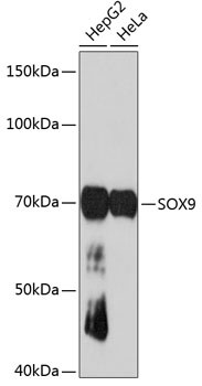 SOX9 Antibody in Western Blot (WB)