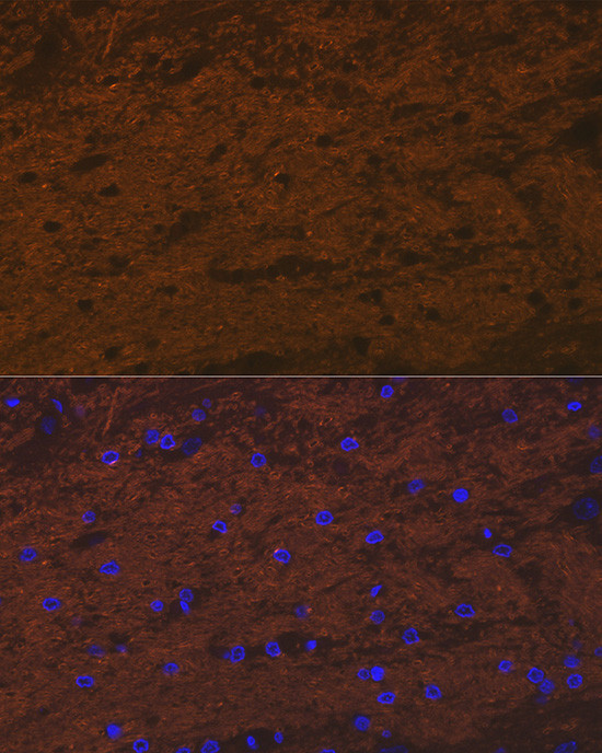 TMOD2 Antibody in Immunocytochemistry (ICC/IF)