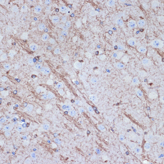 TMOD2 Antibody in Immunohistochemistry (Paraffin) (IHC (P))