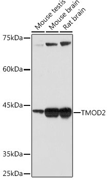 TMOD2 Antibody in Western Blot (WB)