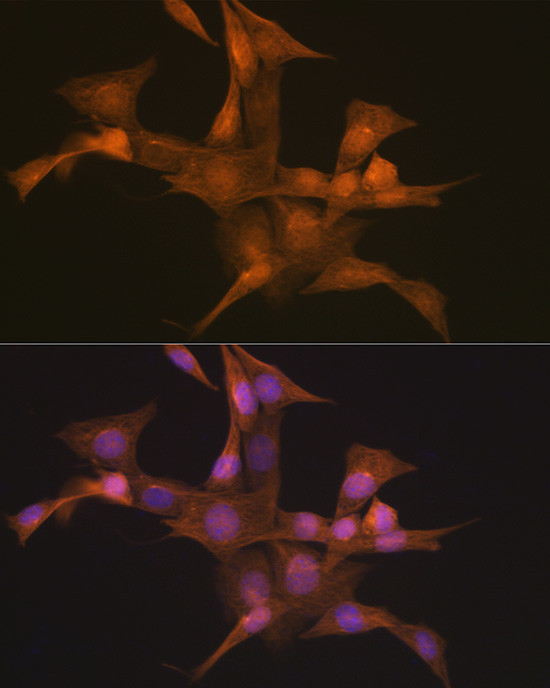 Nesprin 1 Antibody in Immunocytochemistry (ICC/IF)