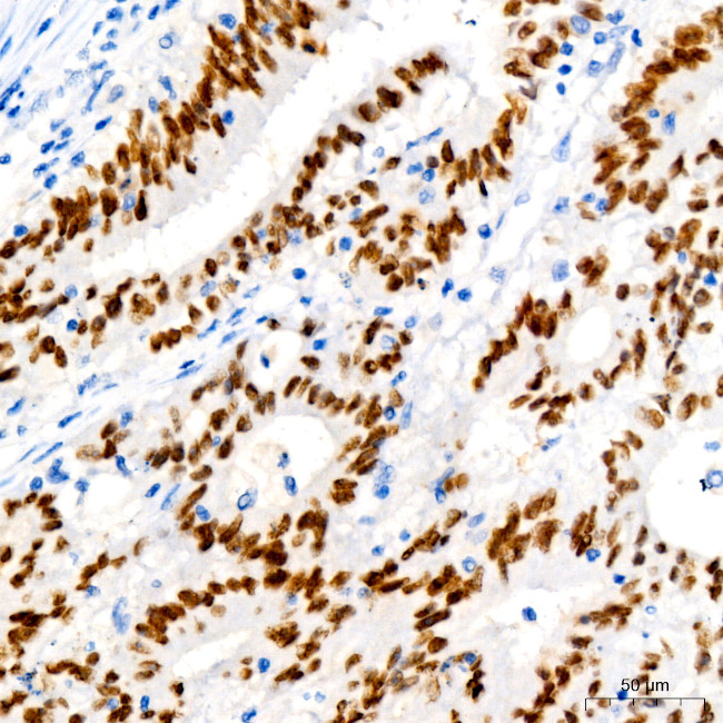 SATB2 Antibody in Immunohistochemistry (Paraffin) (IHC (P))