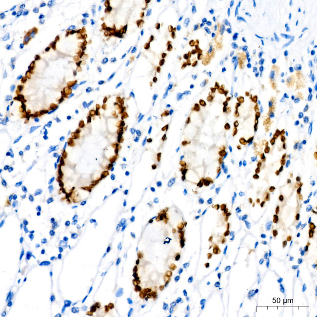 SATB2 Antibody in Immunohistochemistry (Paraffin) (IHC (P))