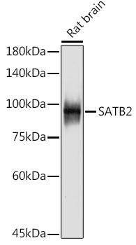 SATB2 Antibody in Western Blot (WB)