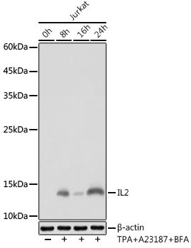 IL-2 Antibody in Western Blot (WB)