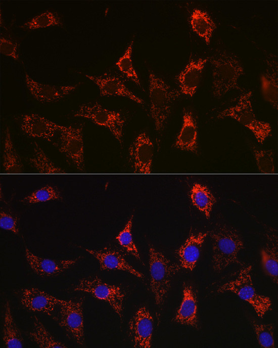 BAX Antibody in Immunocytochemistry (ICC/IF)