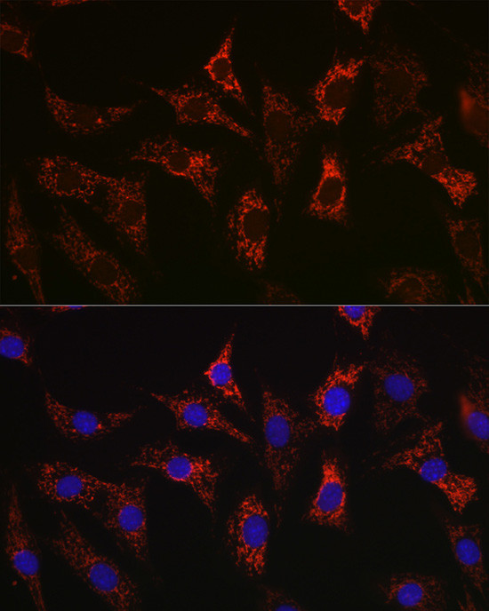 BAX Antibody in Immunocytochemistry (ICC/IF)