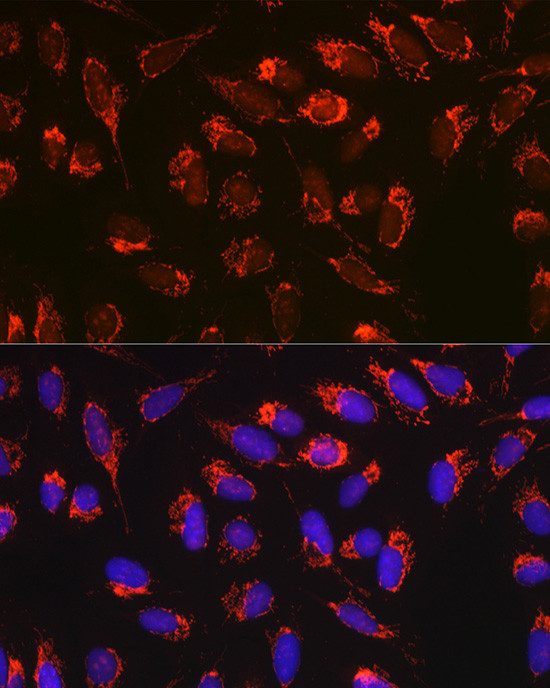 BAX Antibody in Immunocytochemistry (ICC/IF)