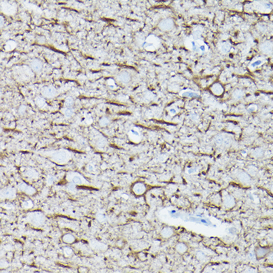 NEFL Antibody in Immunohistochemistry (Paraffin) (IHC (P))