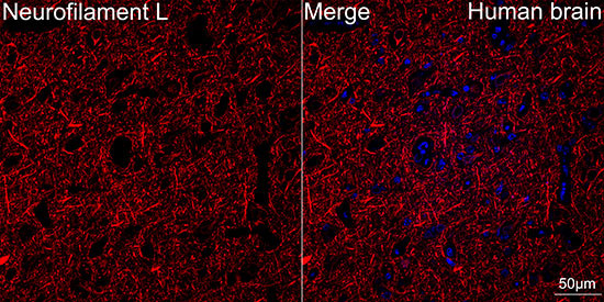 NEFL Antibody in Immunohistochemistry (Paraffin) (IHC (P))