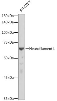 NEFL Antibody in Western Blot (WB)