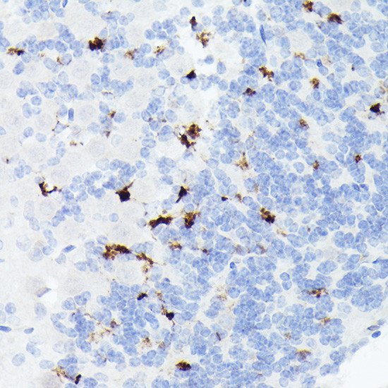 Somatostatin Antibody in Immunohistochemistry (Paraffin) (IHC (P))