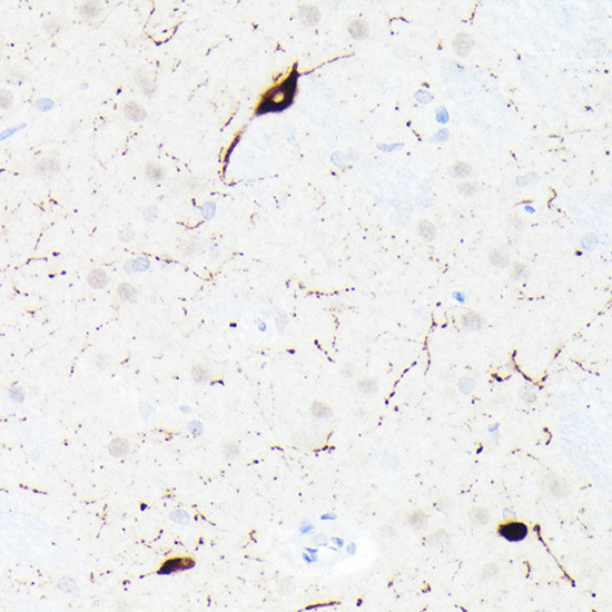 Somatostatin Antibody in Immunohistochemistry (Paraffin) (IHC (P))