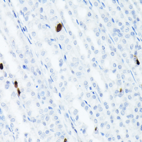 Somatostatin Antibody in Immunohistochemistry (Paraffin) (IHC (P))