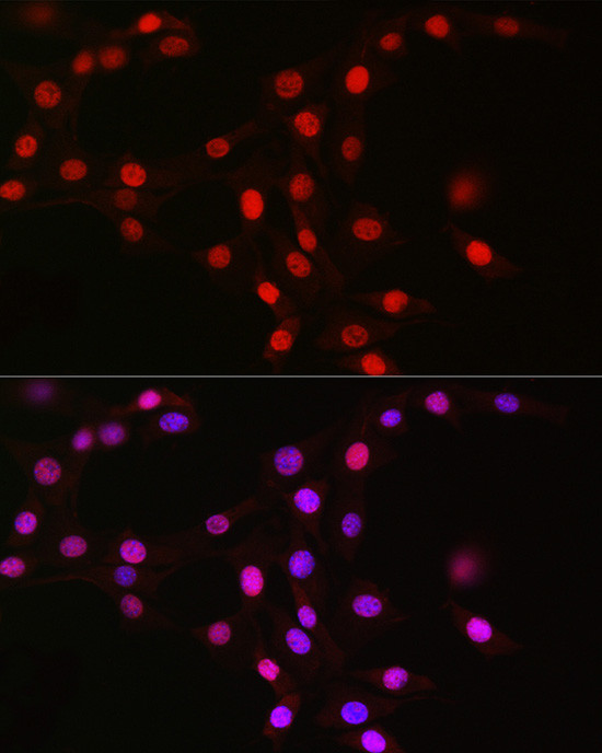 MCM2 Antibody in Immunocytochemistry (ICC/IF)