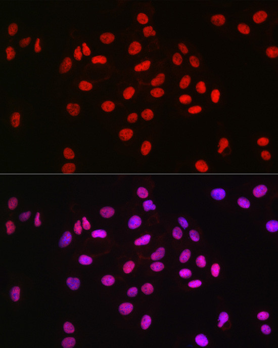 MCM2 Antibody in Immunocytochemistry (ICC/IF)