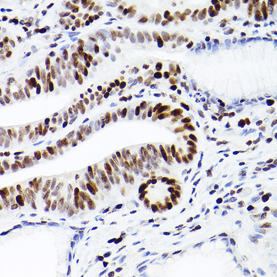 MCM2 Antibody in Immunohistochemistry (Paraffin) (IHC (P))