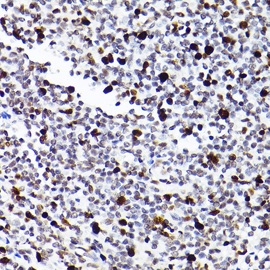 MCM2 Antibody in Immunohistochemistry (Paraffin) (IHC (P))