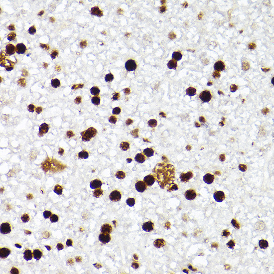 MCM2 Antibody in Immunohistochemistry (Paraffin) (IHC (P))