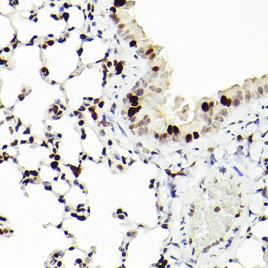 MCM2 Antibody in Immunohistochemistry (Paraffin) (IHC (P))