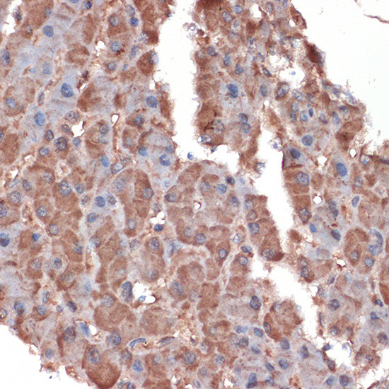 ApoC3 Antibody in Immunohistochemistry (Paraffin) (IHC (P))