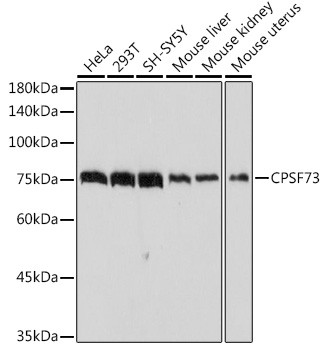 CPSF3 Antibody in Western Blot (WB)