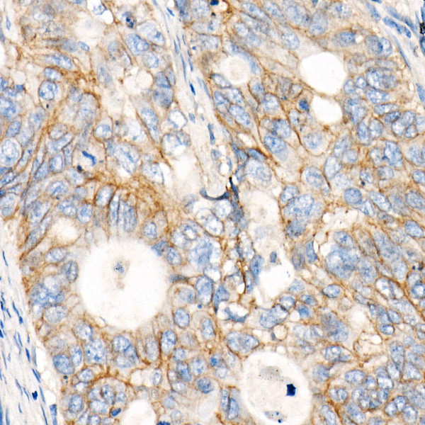 MRP1 Antibody in Immunohistochemistry (Paraffin) (IHC (P))