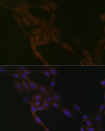 SMURF2 Antibody in Immunocytochemistry (ICC/IF)