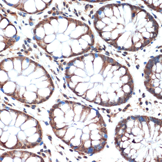 SMURF2 Antibody in Immunohistochemistry (Paraffin) (IHC (P))