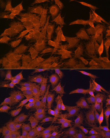 SRP54 Antibody in Immunocytochemistry (ICC/IF)