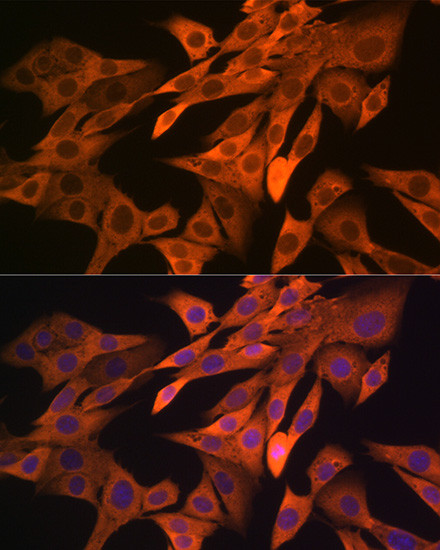 SRP54 Antibody in Immunocytochemistry (ICC/IF)