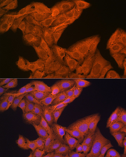 SRP54 Antibody in Immunocytochemistry (ICC/IF)