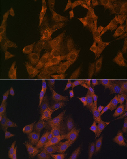 Zyxin Antibody in Immunocytochemistry (ICC/IF)