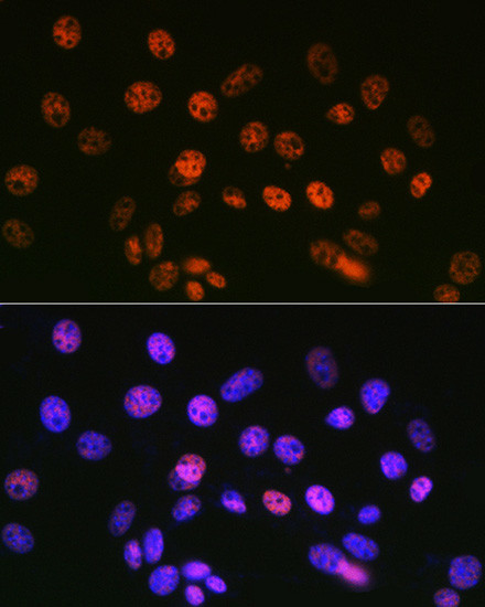 SIN3A Antibody in Immunocytochemistry (ICC/IF)