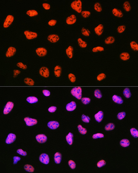 SIN3A Antibody in Immunocytochemistry (ICC/IF)