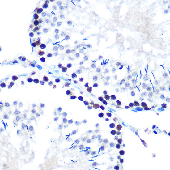 SIN3A Antibody in Immunohistochemistry (Paraffin) (IHC (P))