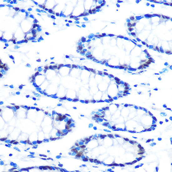 SIN3A Antibody in Immunohistochemistry (Paraffin) (IHC (P))