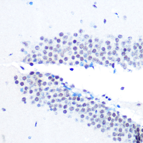 SIN3A Antibody in Immunohistochemistry (Paraffin) (IHC (P))