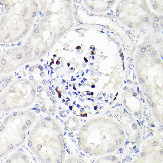 WT1 Antibody in Immunohistochemistry (Paraffin) (IHC (P))