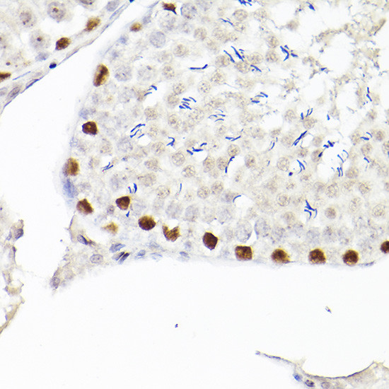 WT1 Antibody in Immunohistochemistry (Paraffin) (IHC (P))